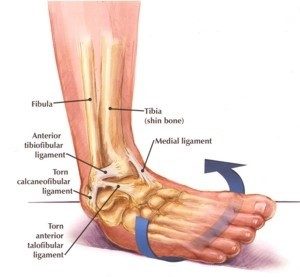 ankle instability victoria bc