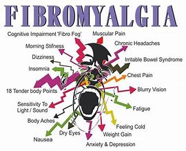 Fibromyalgia Victoria BC