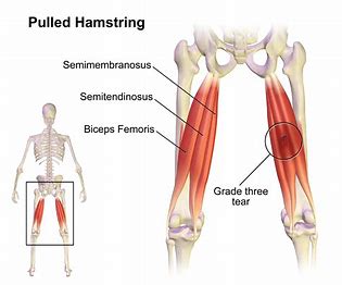 hamstring tera victoria bc